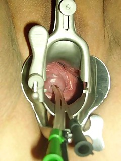 photo gallery id 174