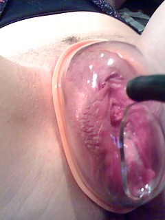 photo gallery id 400