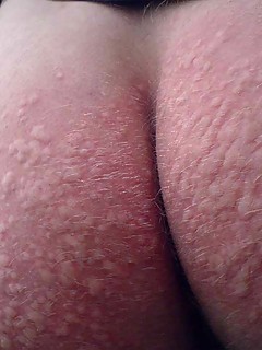 photo gallery id 146